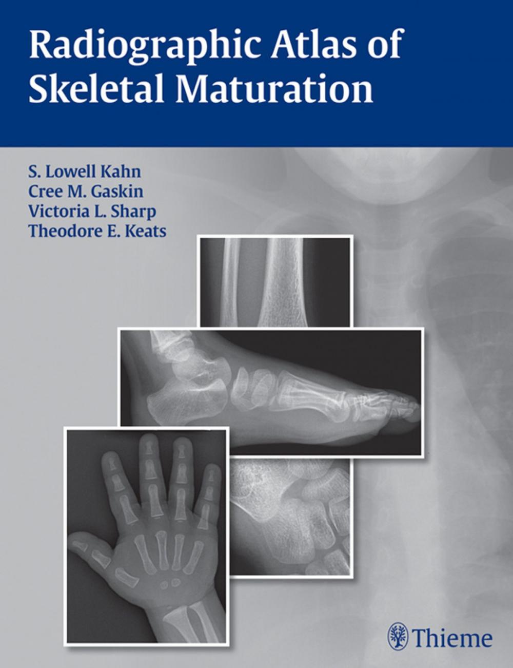 Big bigCover of Radiographic Atlas of Skeletal Maturation