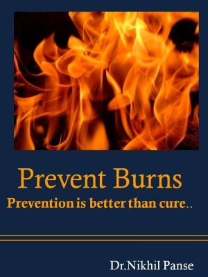 Cover of the book Prevent Burns..Prevention is better than cure by Austin HSEM