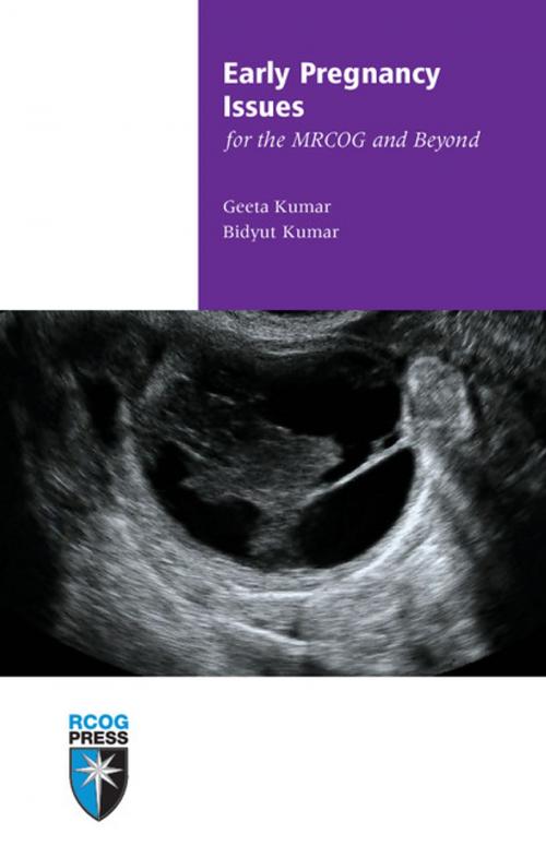 Cover of the book Early Pregnancy Issues for the MRCOG and Beyond by Geeta Kumar, Bidyut Kumar, Royal College of Obstetricians and Gynaecologists (RCOG)