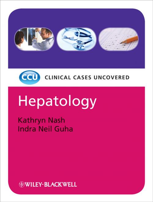 Cover of the book Hepatology: Clinical Cases Uncovered by Kathryn Nash, Indra Neil Guha, Wiley