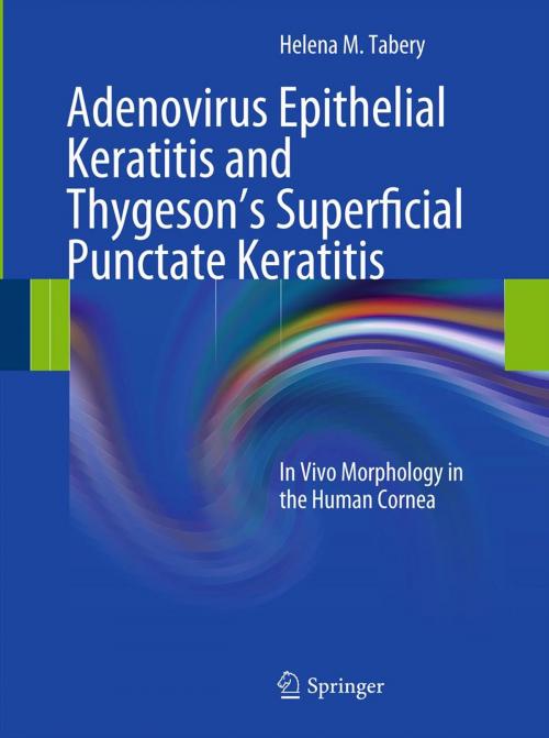 Cover of the book Adenovirus Epithelial Keratitis and Thygeson's Superficial Punctate Keratitis by Helena M. Tabery, Springer Berlin Heidelberg