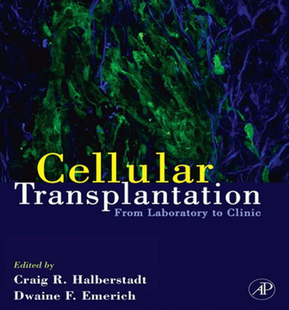 Big bigCover of Cellular Transplantation