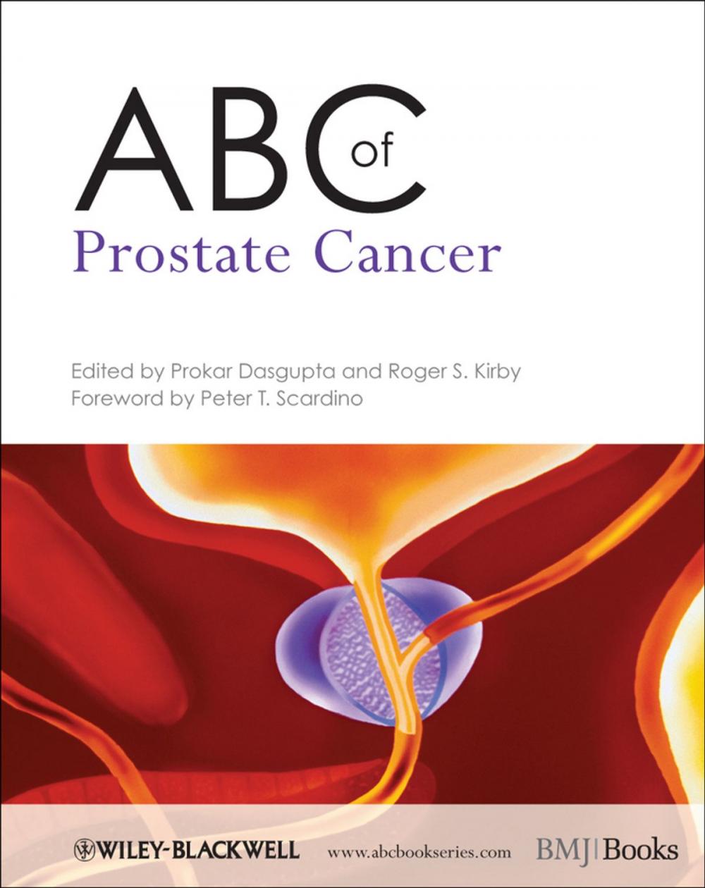 Big bigCover of ABC of Prostate Cancer