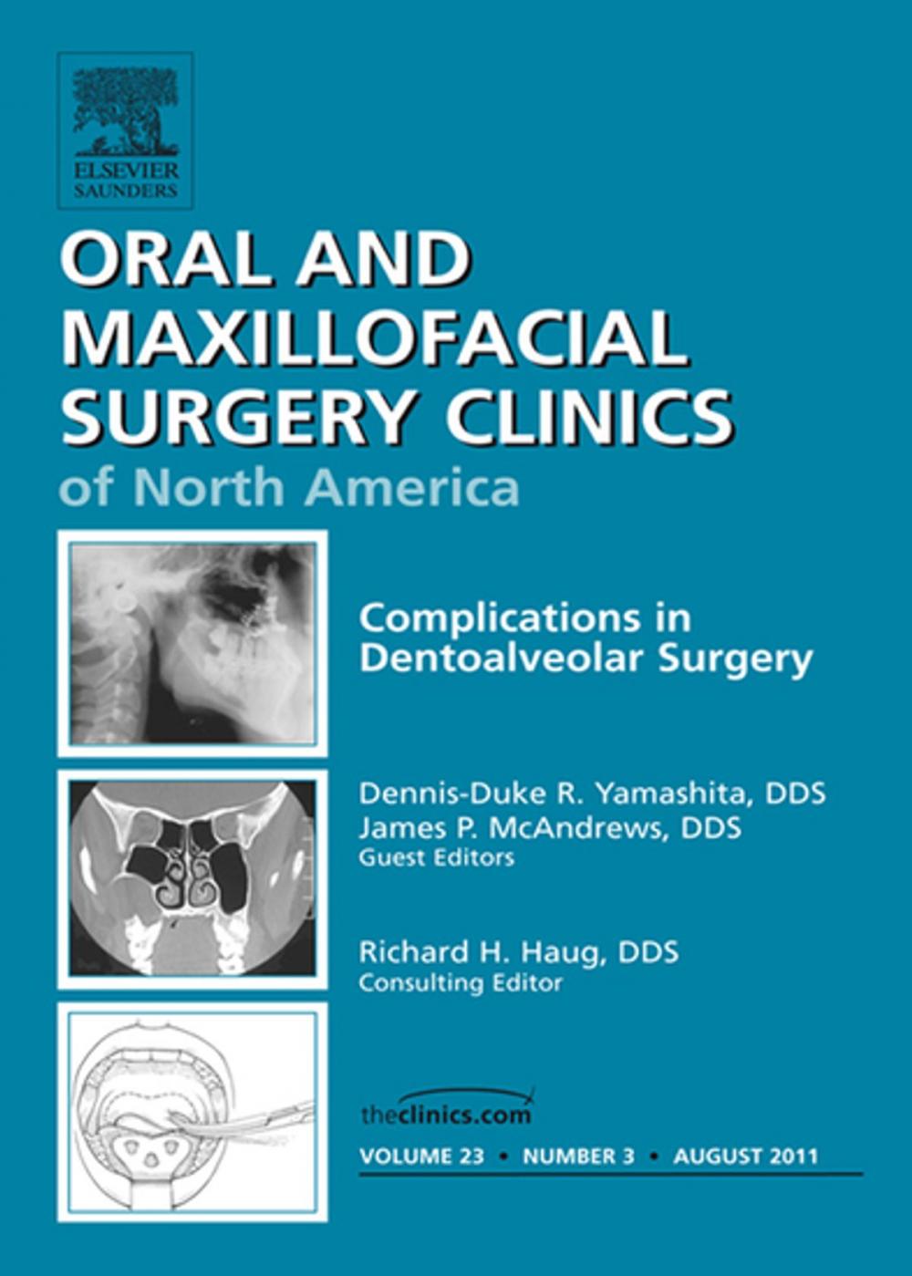 Big bigCover of Dento-Alveolar Complications, An Issue of Oral and Maxillofacial Surgery Clinics - E-Book