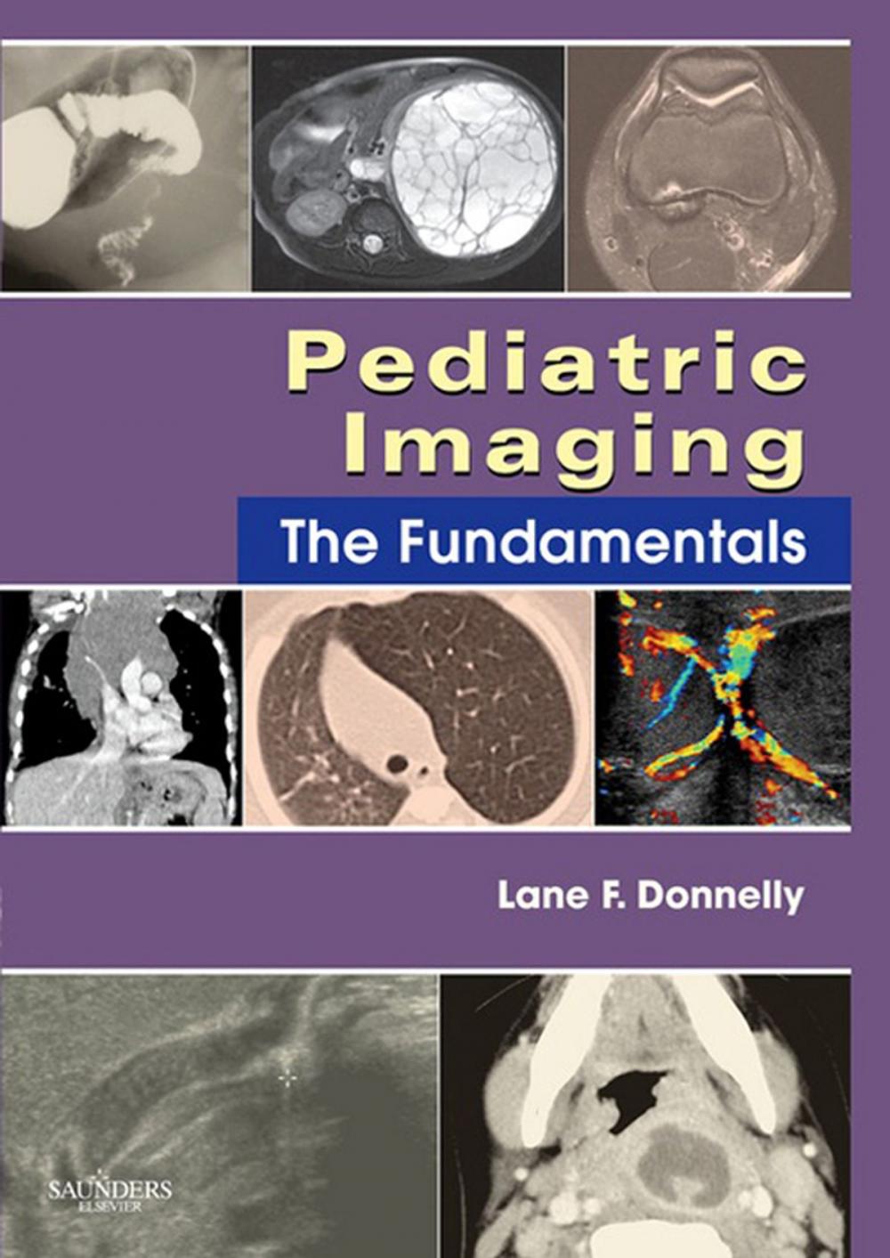 Big bigCover of Pediatric Imaging E-Book