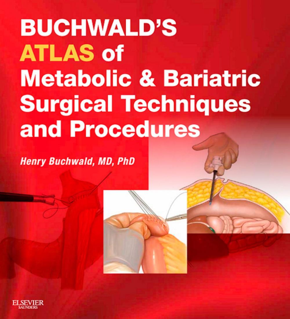 Big bigCover of Buchwald's Atlas of Metabolic & Bariatric Surgical Techniques and Procedures E-Book