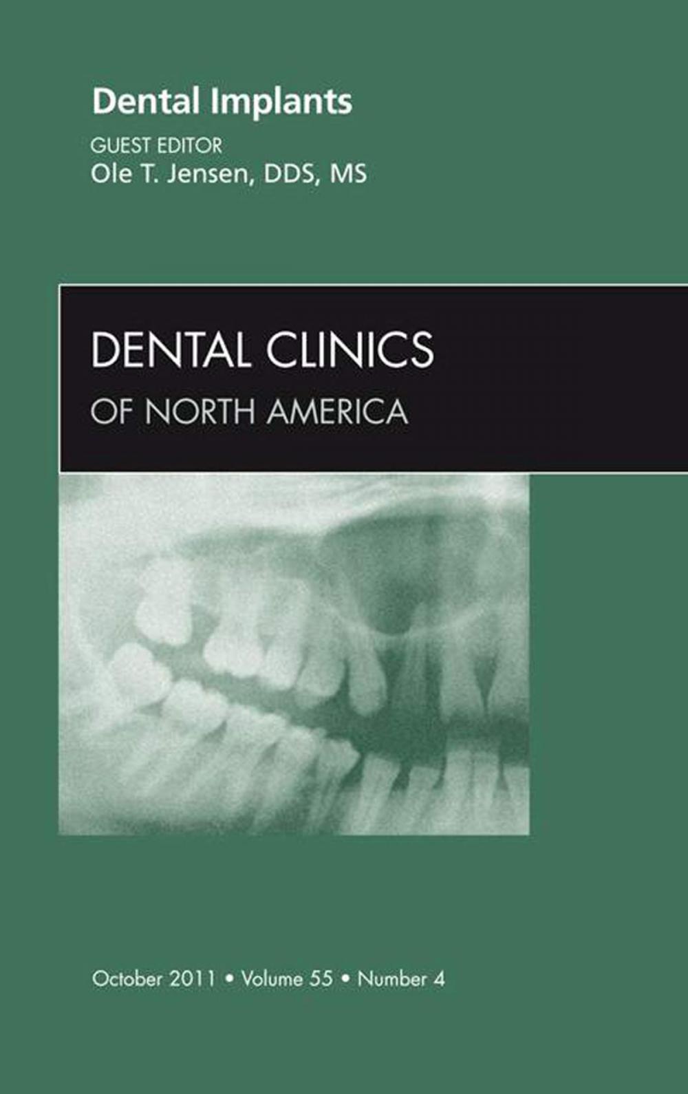 Big bigCover of Dental Implants, An Issue of Dental Clinics - E-Book