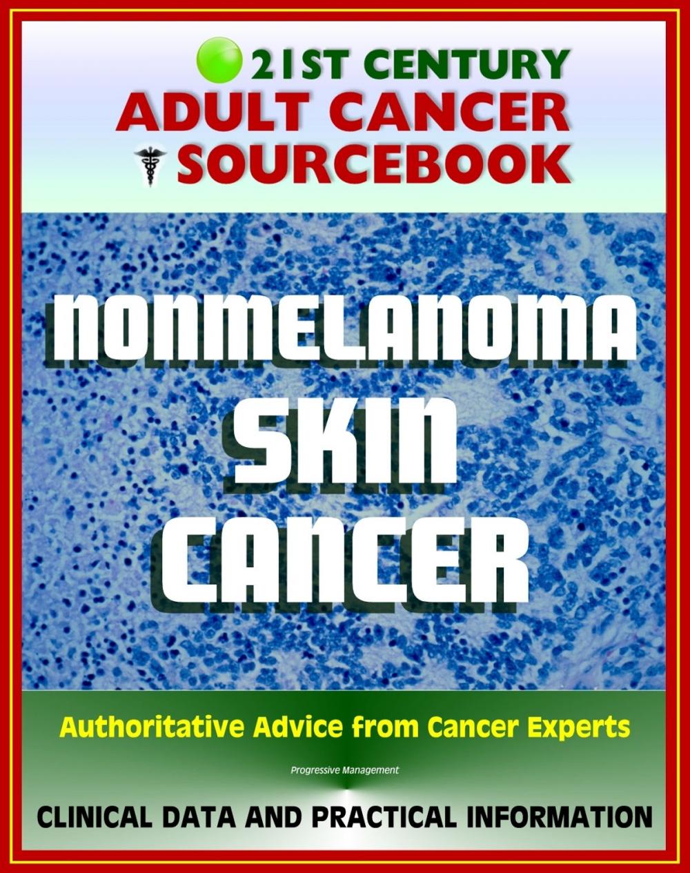 Big bigCover of 21st Century Adult Cancer Sourcebook: Nonmelanoma Skin Cancer - Squamous Cell Carcinoma and Basal Cell Carcinoma (BCC and SCC) - Clinical Data for Patients, Families, and Physicians