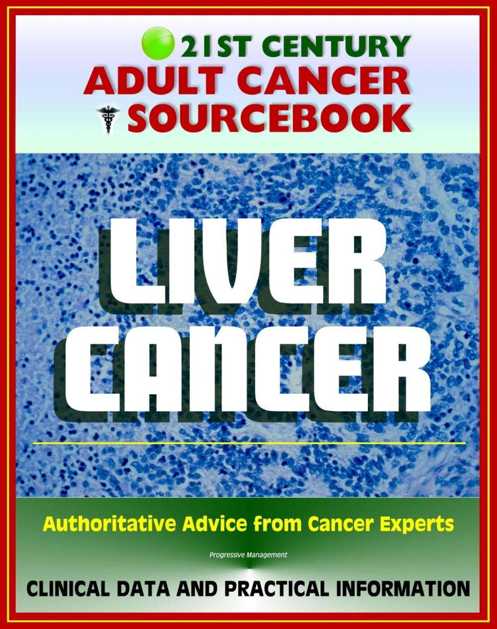 Big bigCover of 21st Century Adult Cancer Sourcebook: Liver Cancer, Hepatocellular Carcinoma (HCC) - Clinical Data for Patients, Families, and Physicians