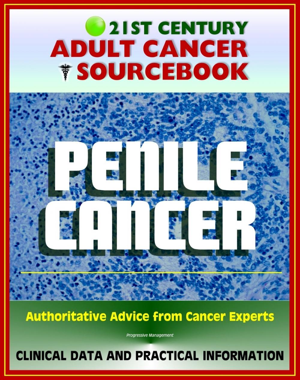 Big bigCover of 21st Century Adult Cancer Sourcebook: Penile Cancer (Cancer of the Penis) - Clinical Data for Patients, Families, and Physicians