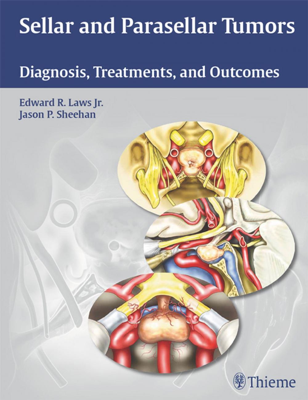 Big bigCover of Sellar and Parasellar Tumors