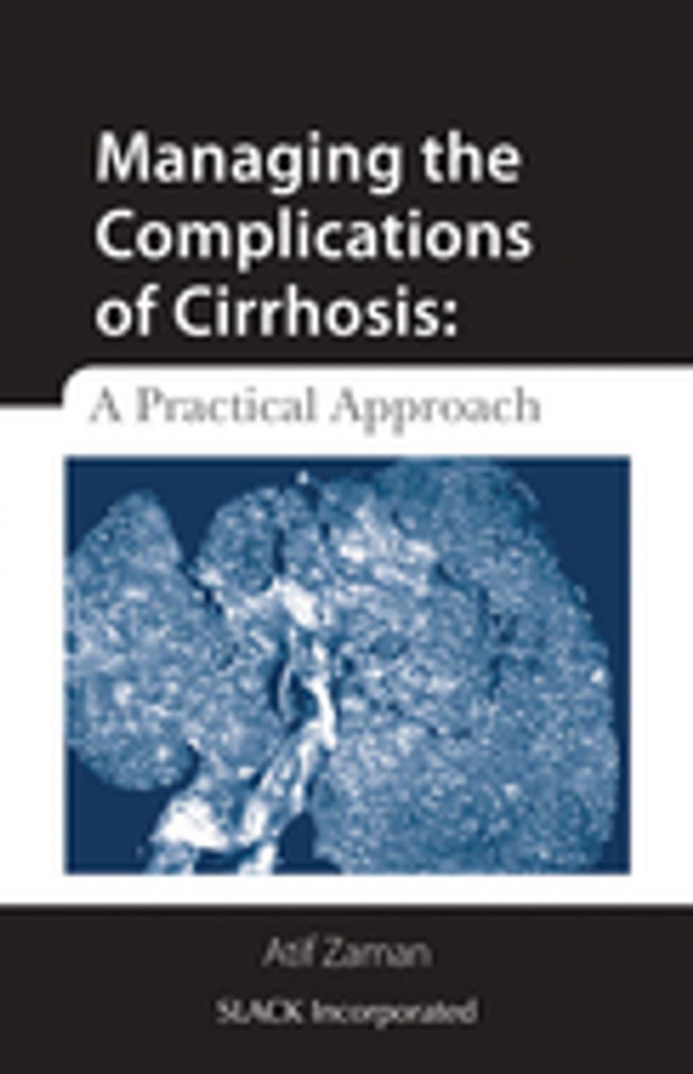 Big bigCover of Managing the Complications of Cirrhosis