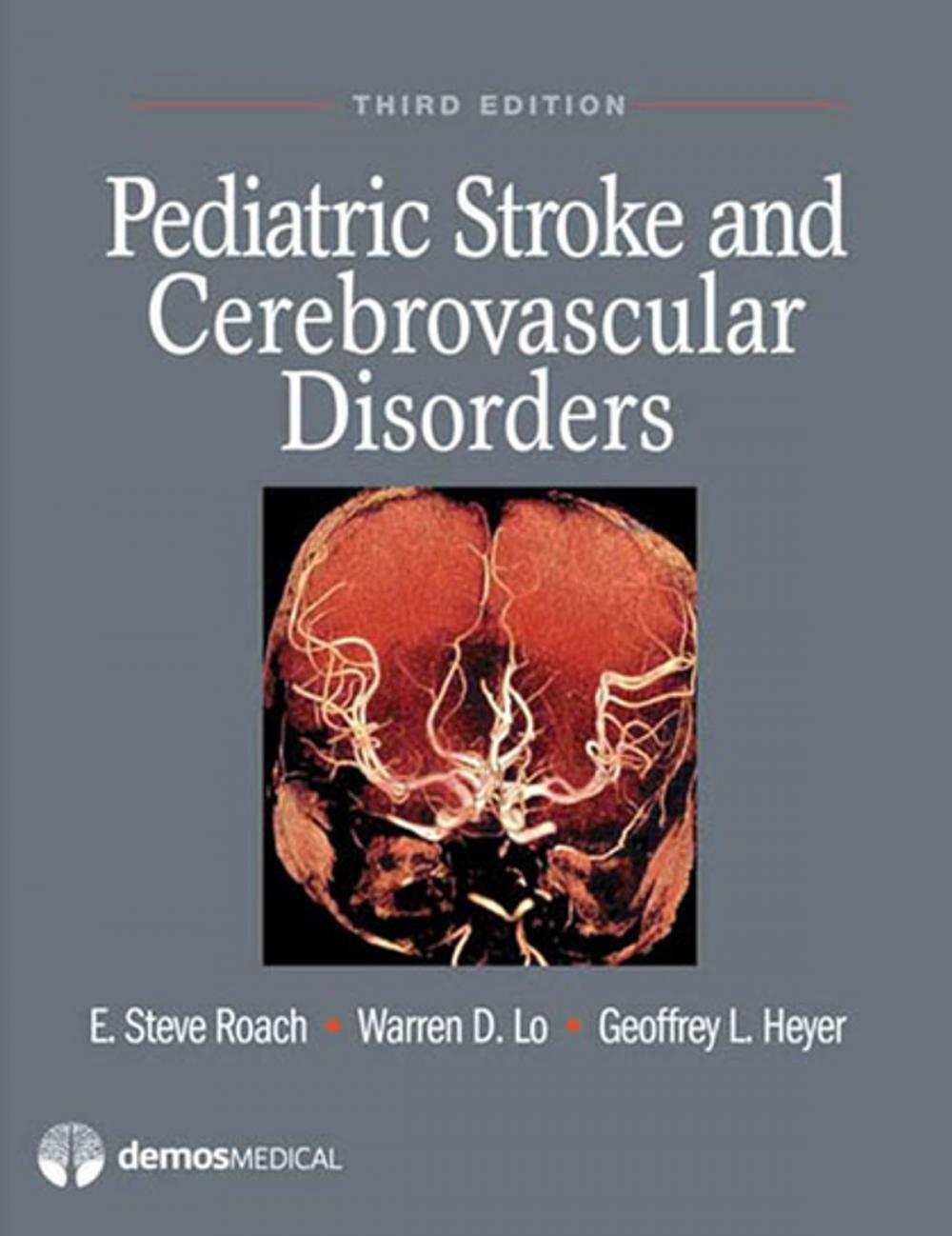 Big bigCover of Pediatric Stroke and Cerebrovascular Disorders