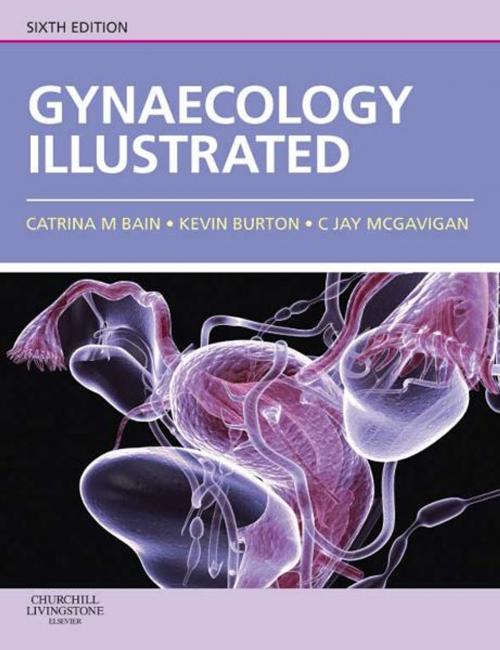 Cover of the book Gynaecology Illustrated E-Book by Catrina Bain, MBChB, MRCOG, Kevin Burton, MD MRCOG, Jay McGavigan, MBBS, MD, MRCOG, FRANZCOG, Elsevier Health Sciences