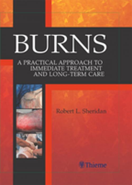 Cover of the book Burns by Robert Sheridan, Thieme