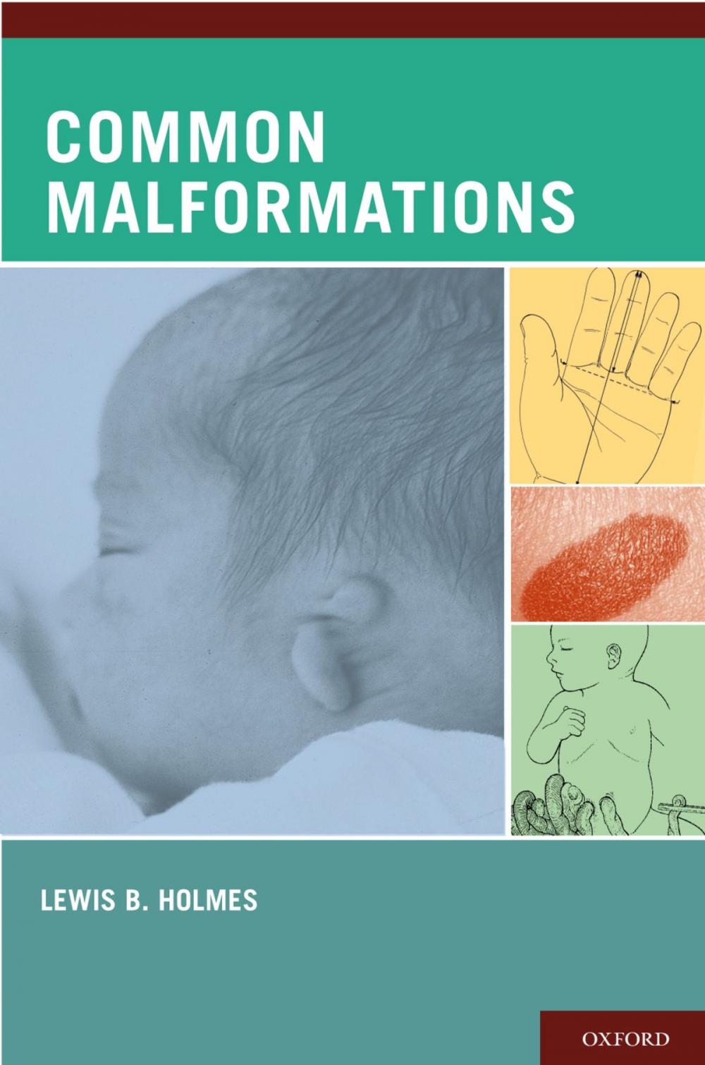 Big bigCover of Common Malformations