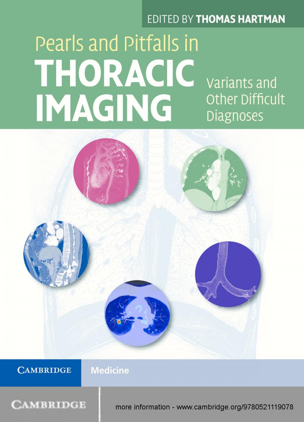 Big bigCover of Pearls and Pitfalls in Thoracic Imaging