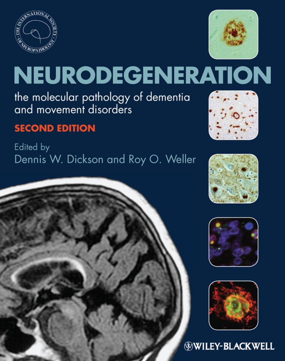 Big bigCover of Neurodegeneration