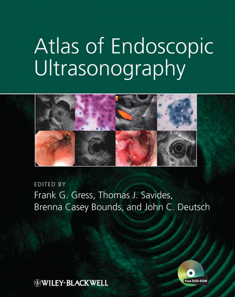 Big bigCover of Atlas of Endoscopic Ultrasonography