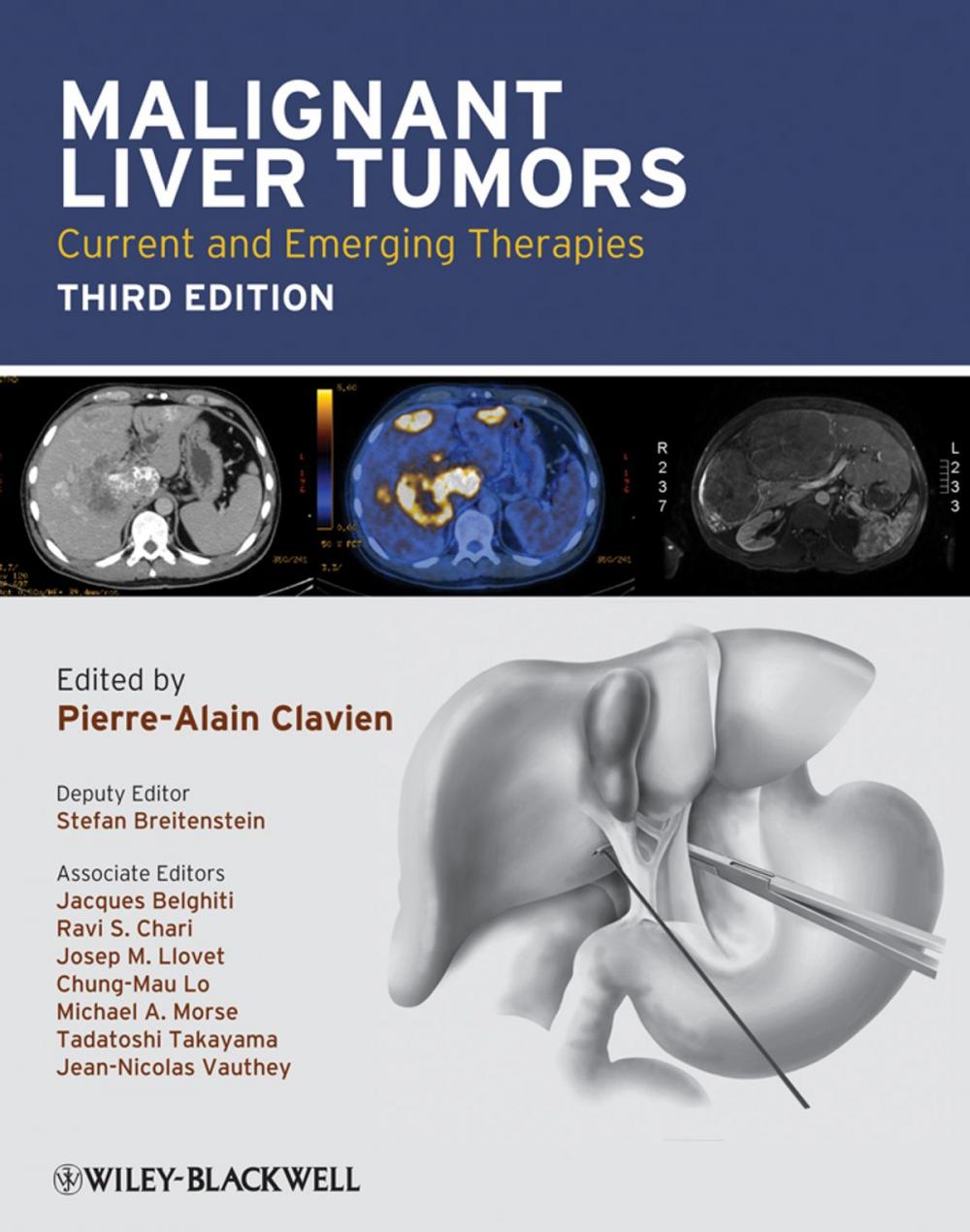 Big bigCover of Malignant Liver Tumors