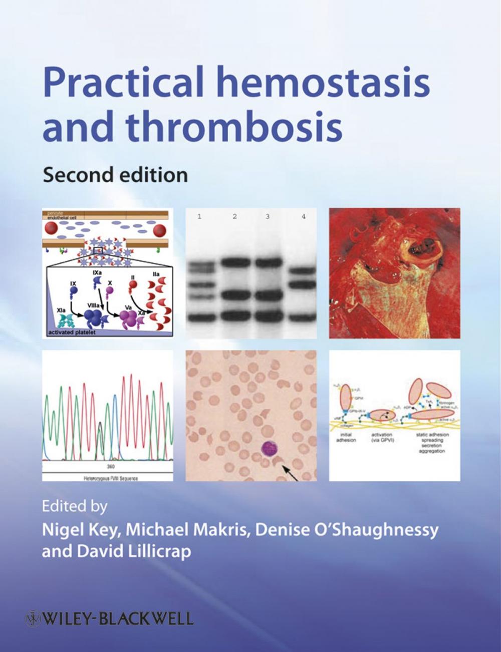 Big bigCover of Practical Hemostasis and Thrombosis