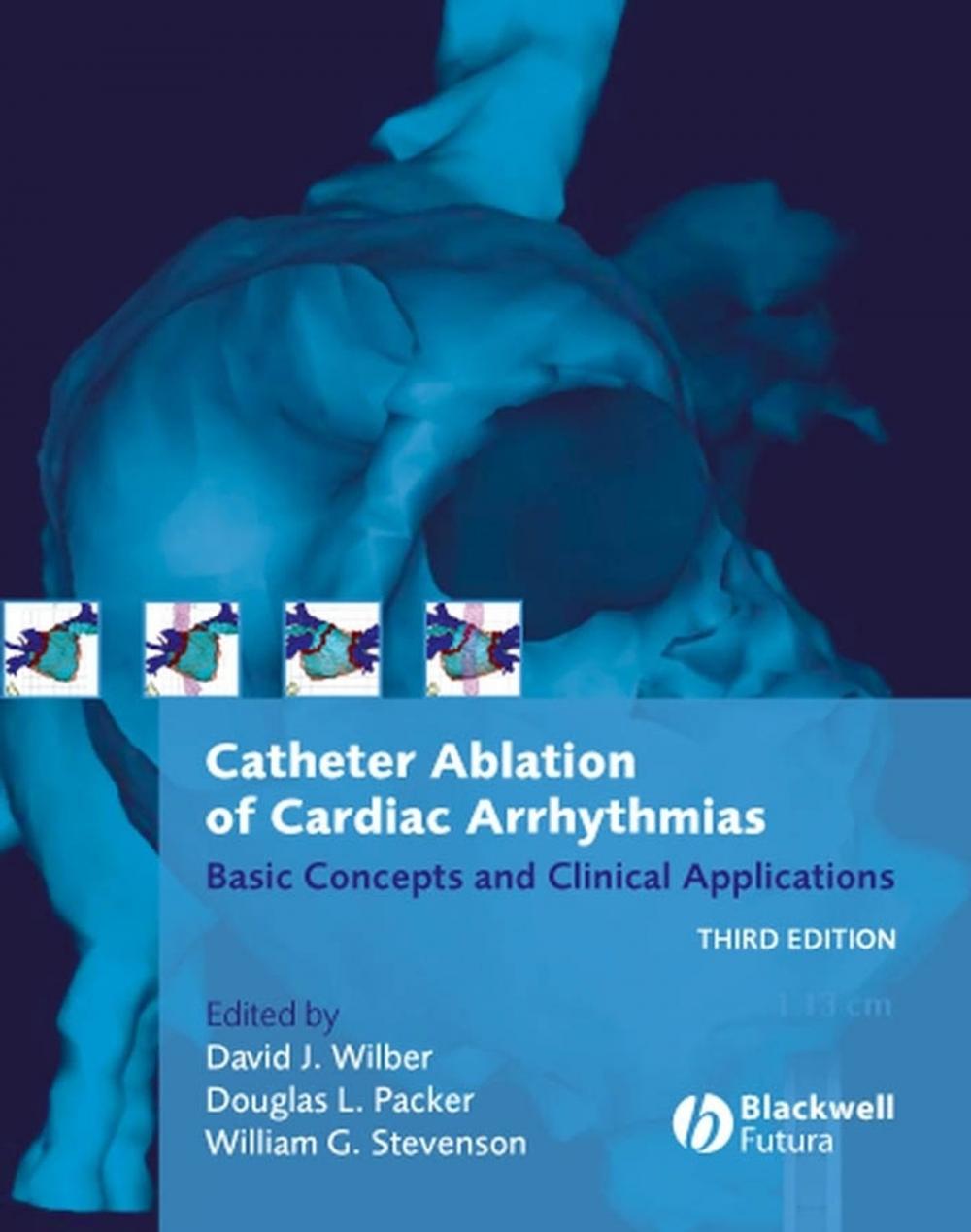 Big bigCover of Catheter Ablation of Cardiac Arrhythmias