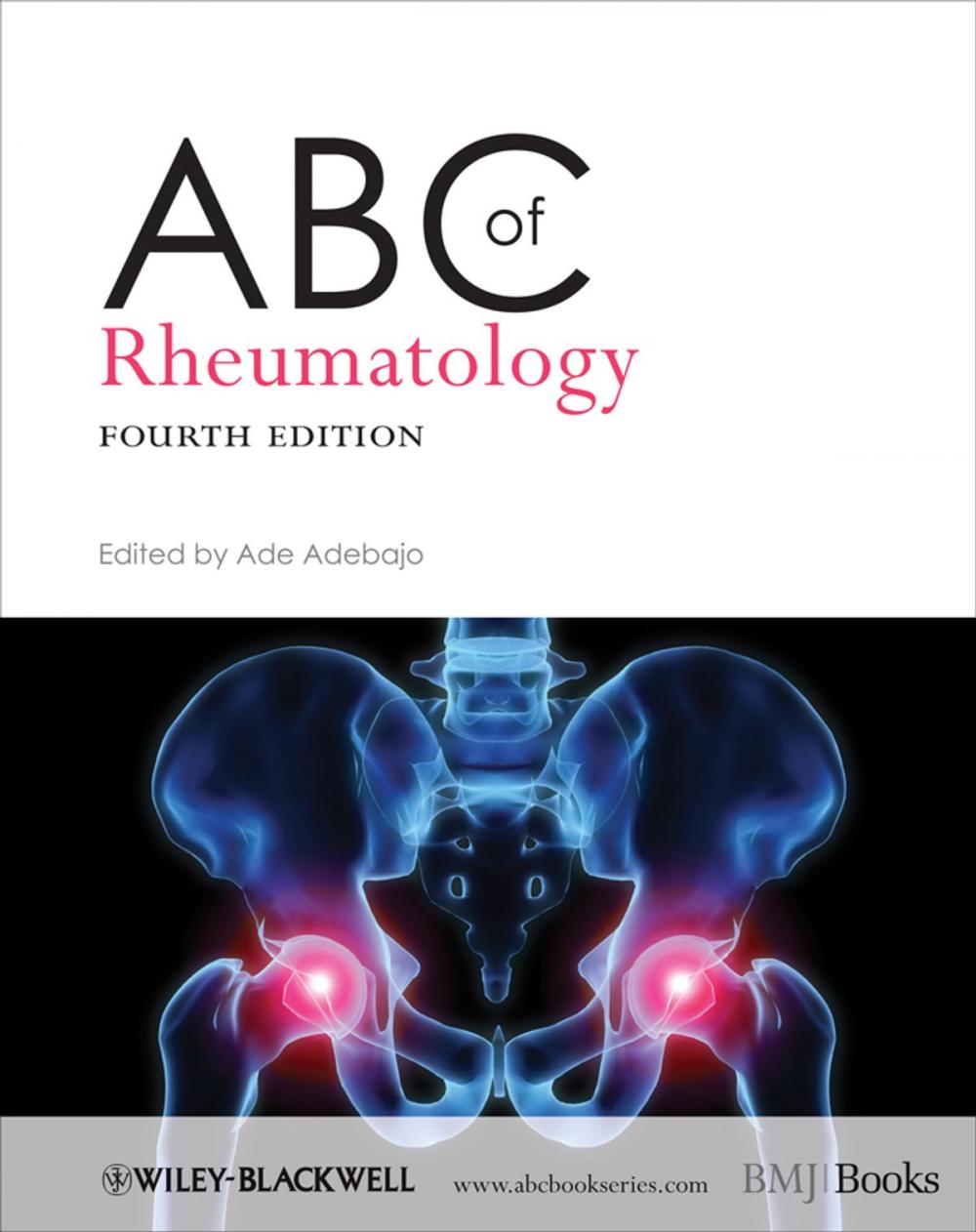 Big bigCover of ABC of Rheumatology