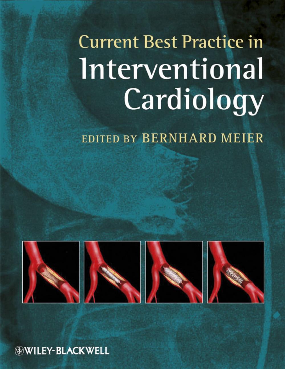 Big bigCover of Current Best Practice in Interventional Cardiology