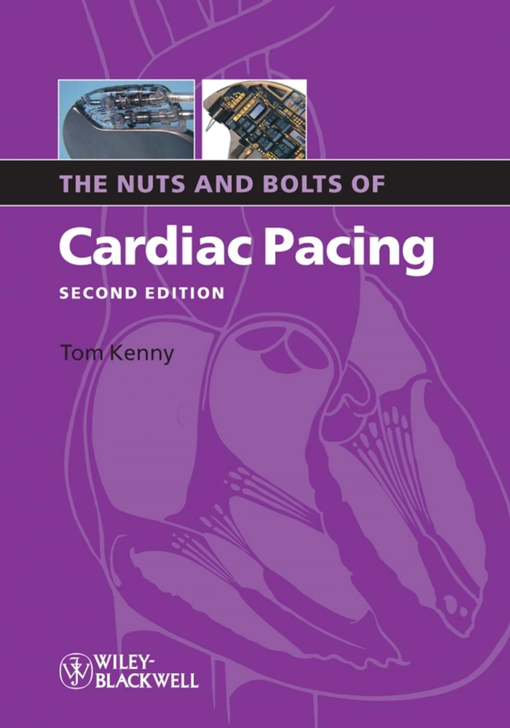 Big bigCover of The Nuts and Bolts of Cardiac Pacing