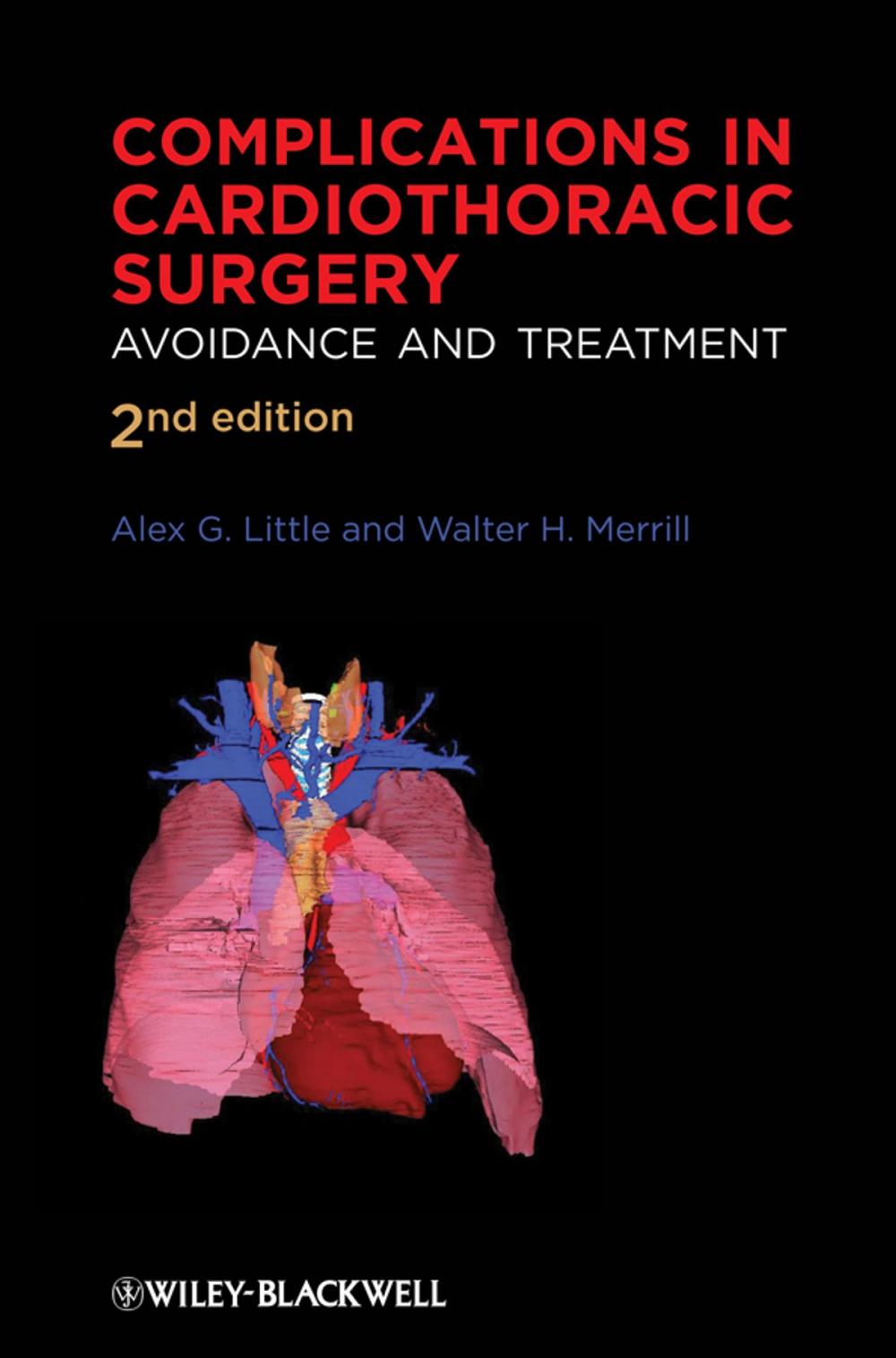 Big bigCover of Complications in Cardiothoracic Surgery