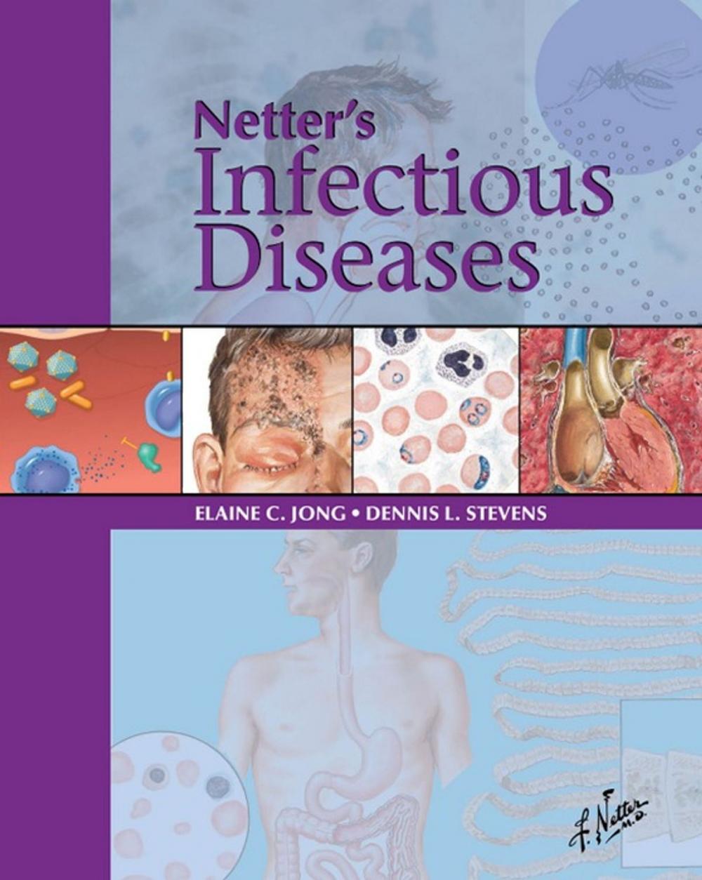 Big bigCover of Netter's Infectious Diseases E-Book