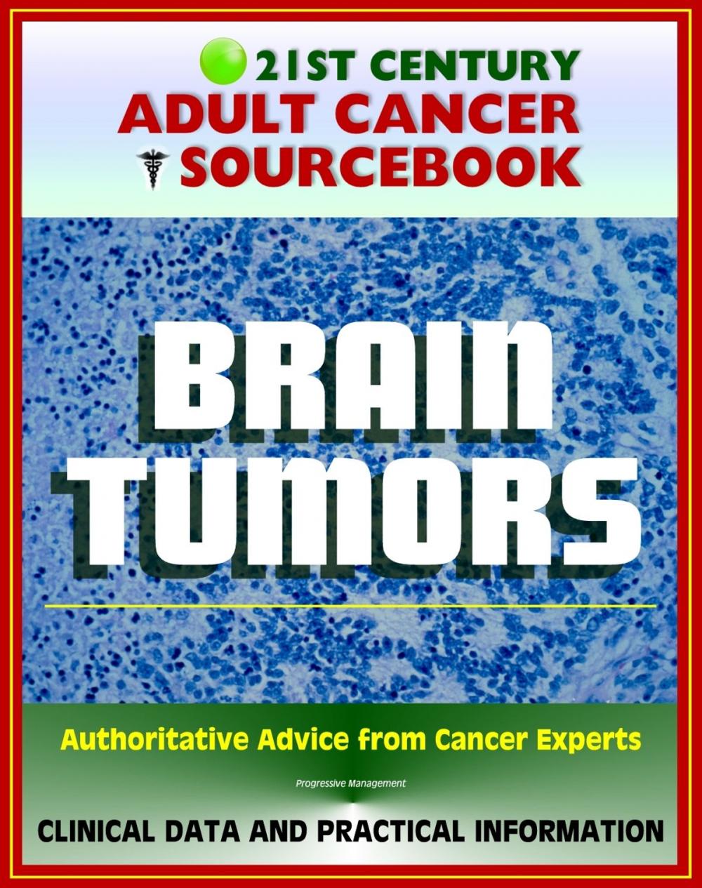 Big bigCover of 21st Century Adult Cancer Sourcebook: Adult Brain Tumors - Primary Malignant Tumors, Glioma, Astrocytoma, Meningioma, Oligodendroglioma, Ependymoma, Glioblastoma