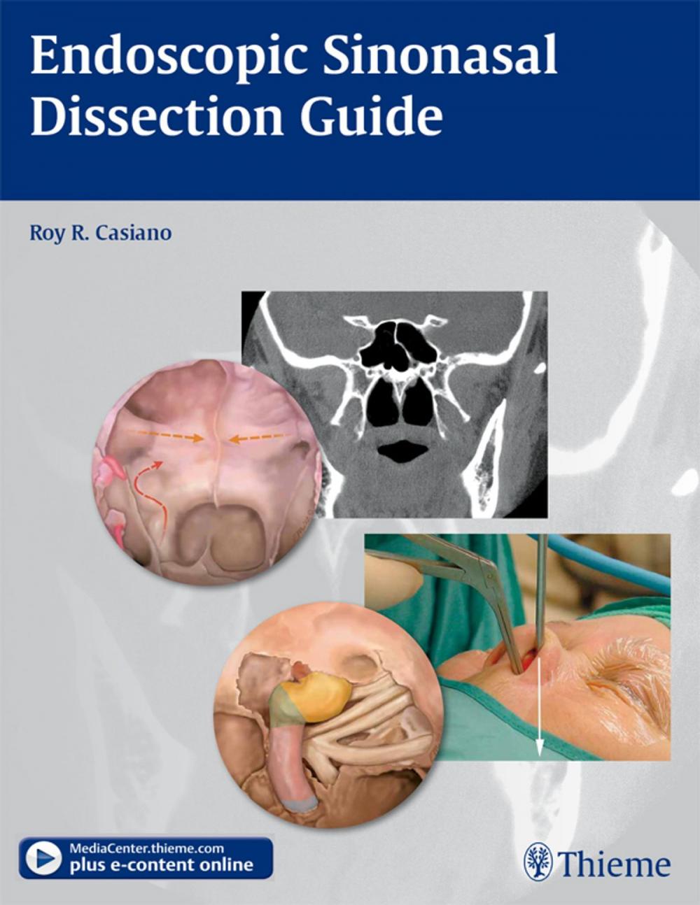 Big bigCover of Endoscopic Sinonasal Dissection Guide