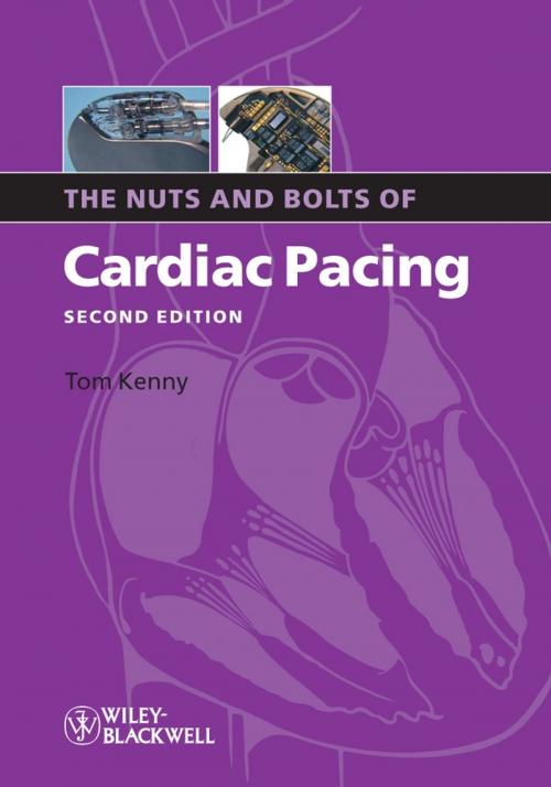 Cover of the book The Nuts and Bolts of Cardiac Pacing by Tom Kenny, Wiley