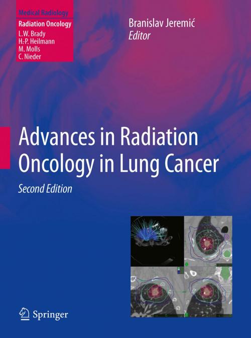 Cover of the book Advances in Radiation Oncology in Lung Cancer by , Springer Berlin Heidelberg