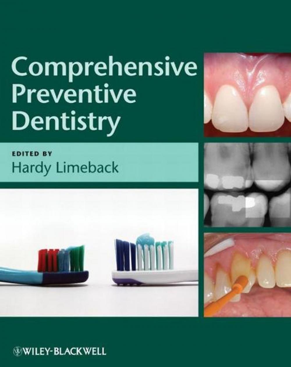 Big bigCover of Comprehensive Preventive Dentistry