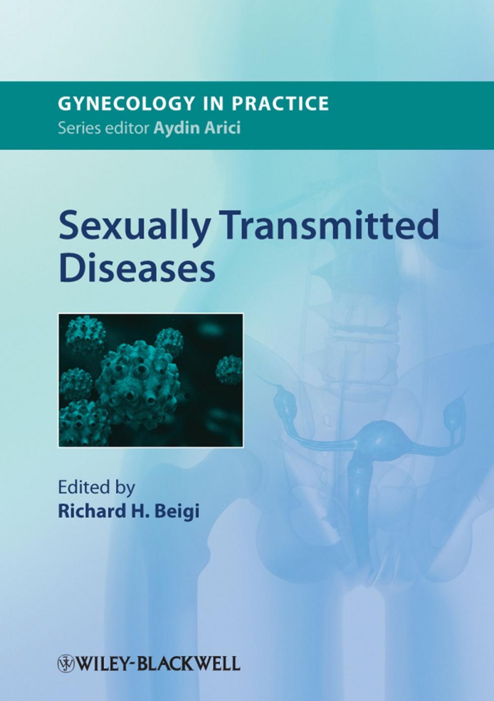 Big bigCover of Sexually Transmitted Diseases