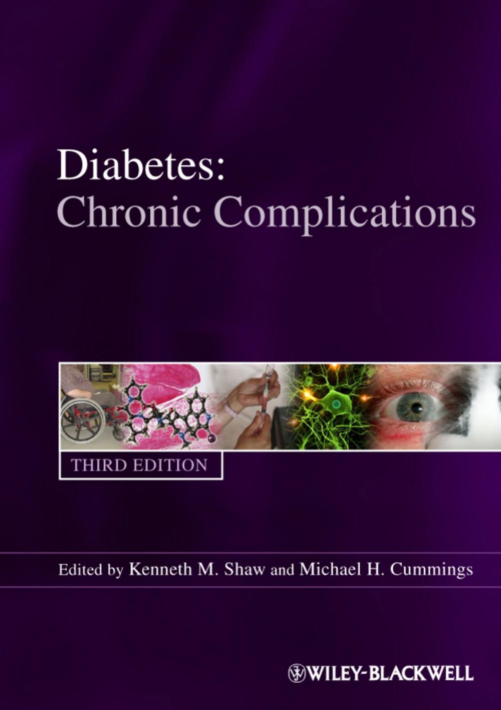 Big bigCover of Diabetes