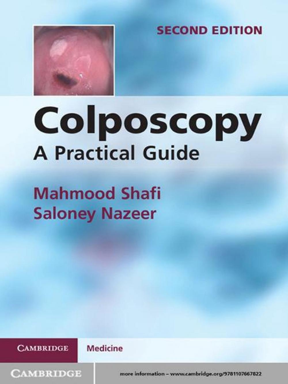 Big bigCover of Colposcopy