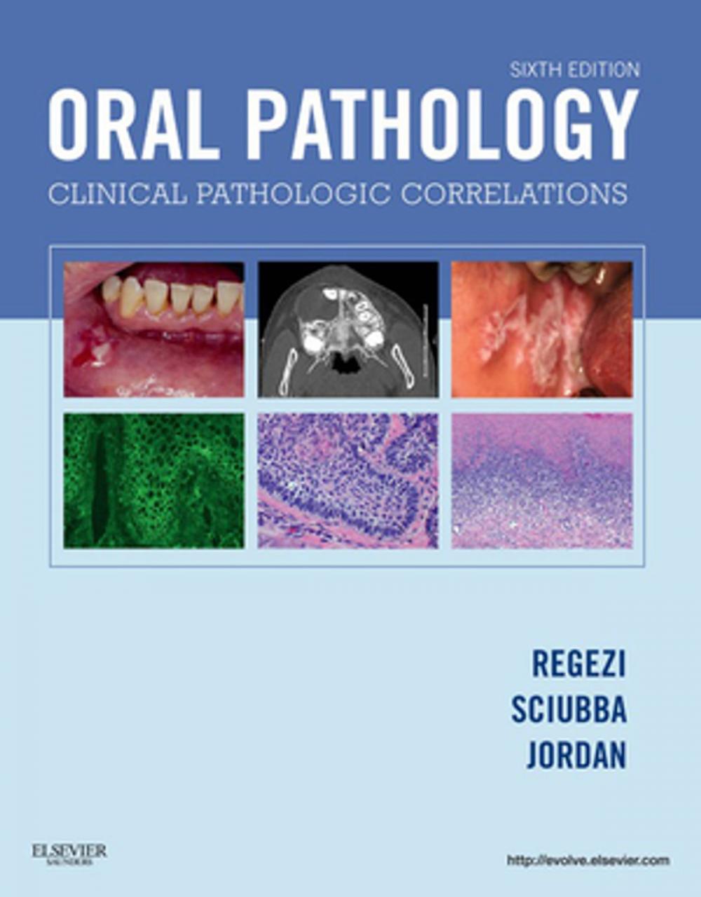 Big bigCover of Oral Pathology - E-Book