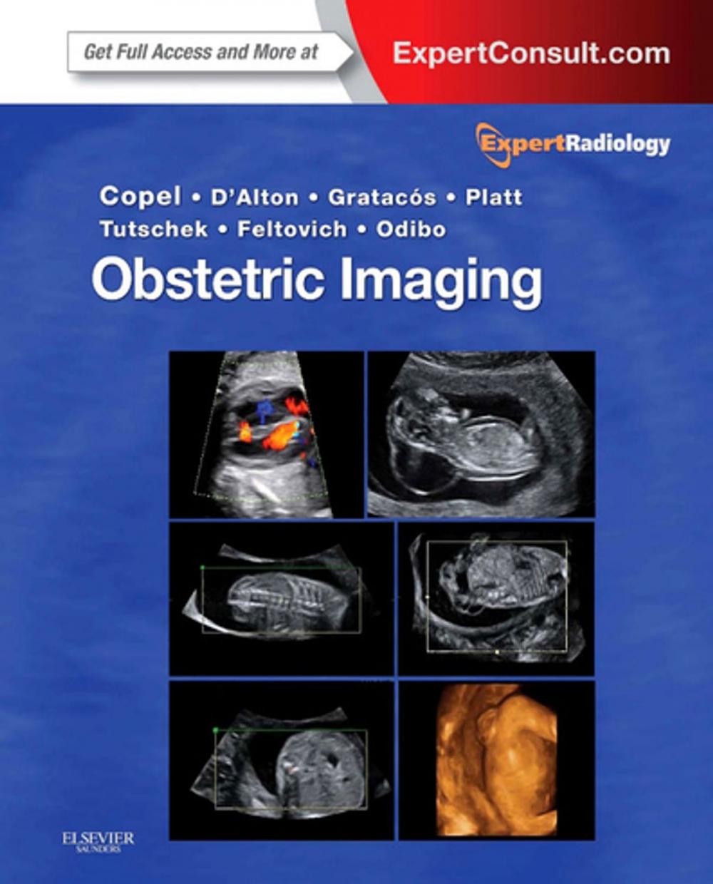 Big bigCover of Obstetric Imaging E-Book