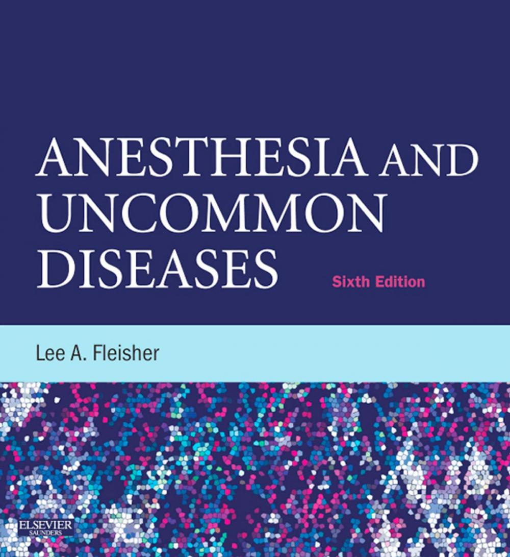 Big bigCover of Anesthesia and Uncommon Diseases E-Book