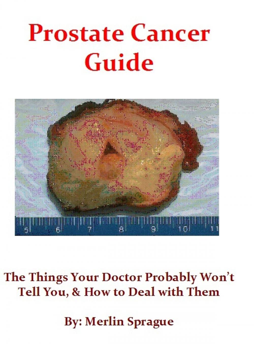 Big bigCover of Prostate Cancer Guide, The Things Your Doctor Probably Won't Tell You, & How To Deal With Them.