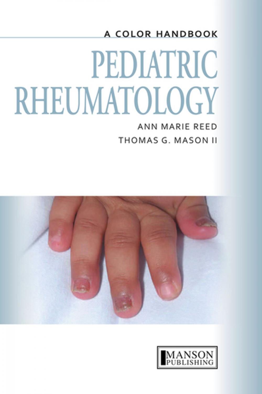 Big bigCover of Pediatric Rheumatology