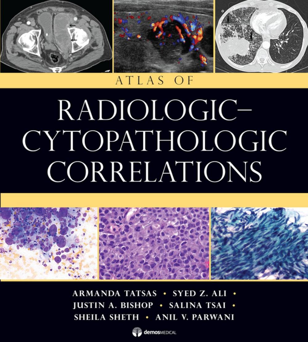 Big bigCover of Atlas of Radiologic-Cytopathologic Correlations