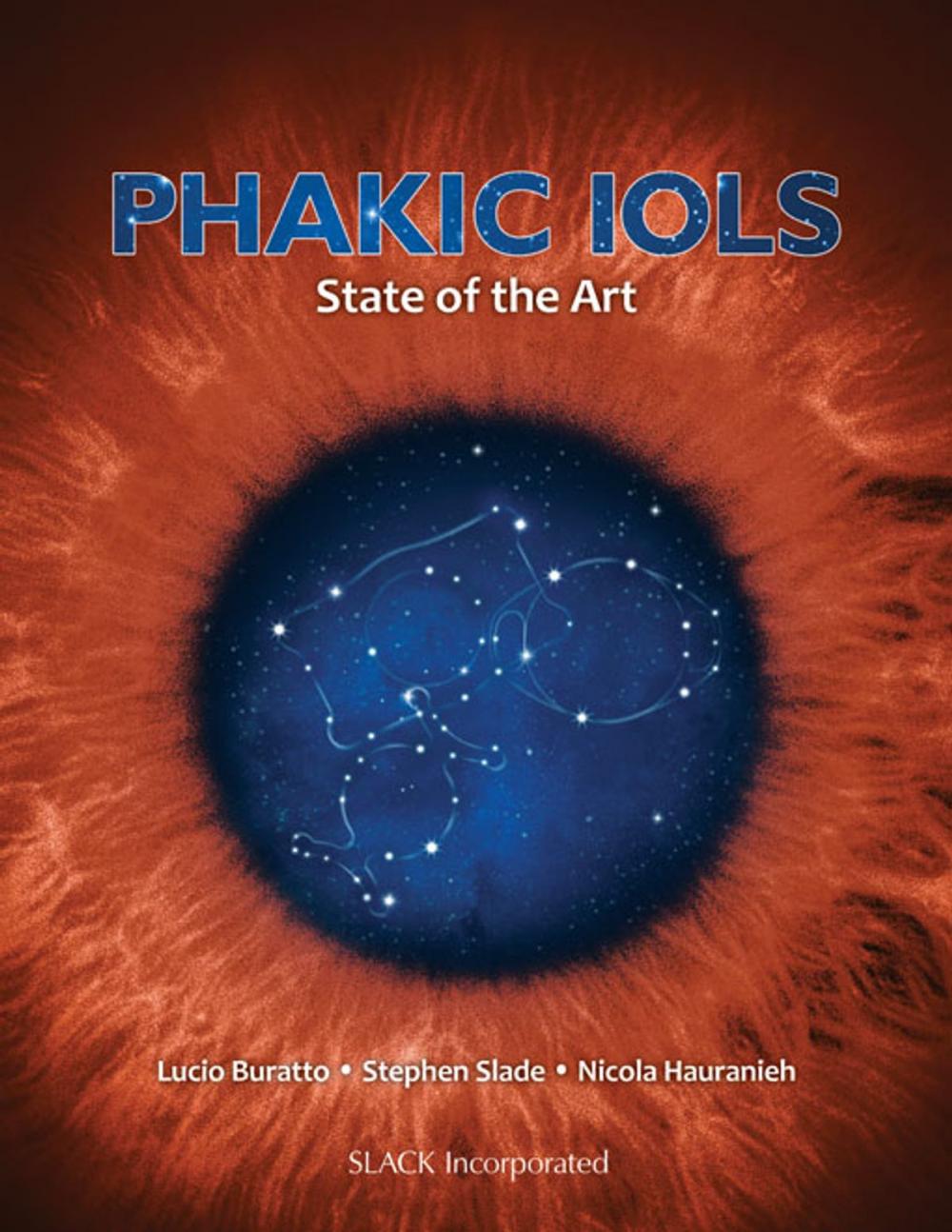 Big bigCover of Phakic IOLs