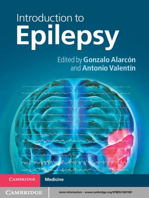 Cover of the book Introduction to Epilepsy by , Cambridge University Press