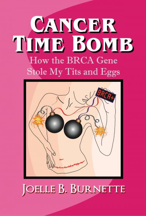 Cover of the book Cancer Time Bomb: How the BRCA Gene Stole My Tits and Eggs by Joelle Burnette, Joelle Burnette