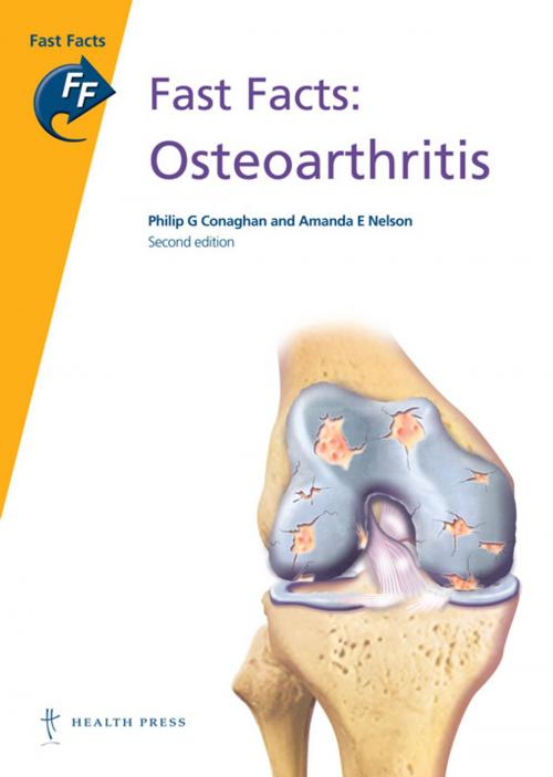Cover of the book Fast Facts: Osteoarthritis by Philip Conaghan, Amanda E Nelson, Health Press Limited