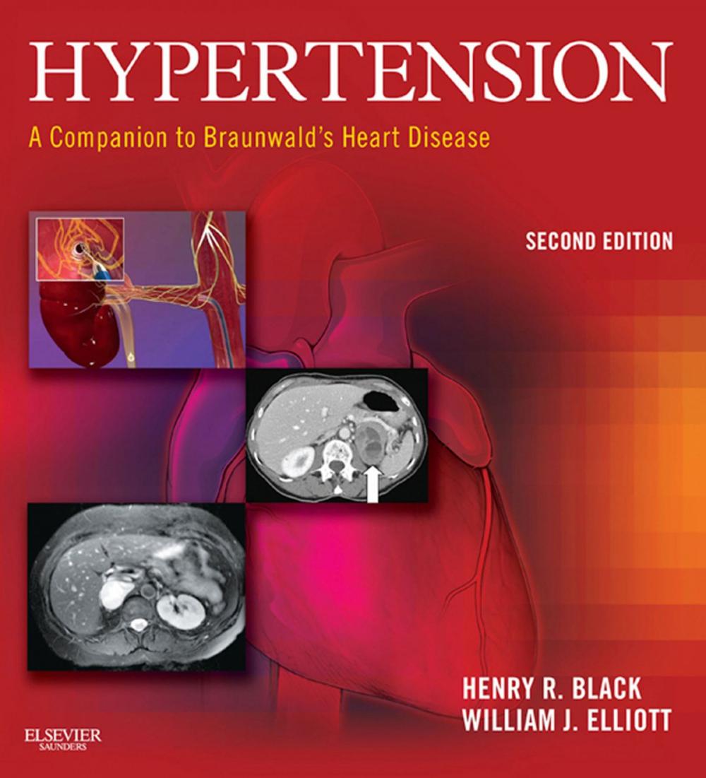 Big bigCover of Hypertension: A Companion to Braunwald's Heart Disease E-Book